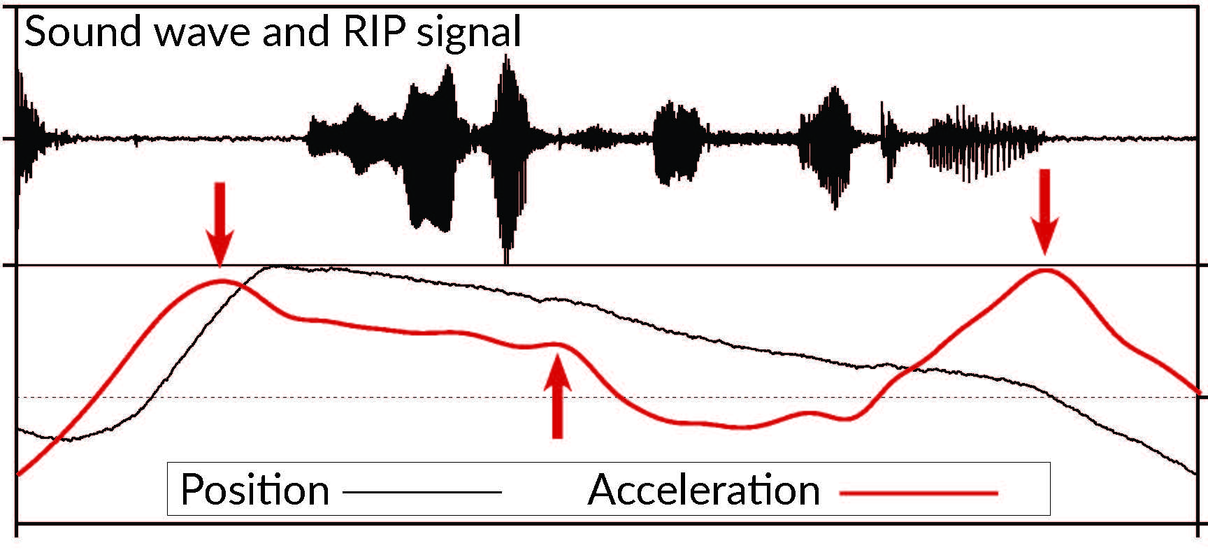TEMPOS signal
